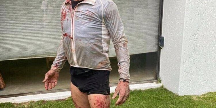 Nick Bester attacked