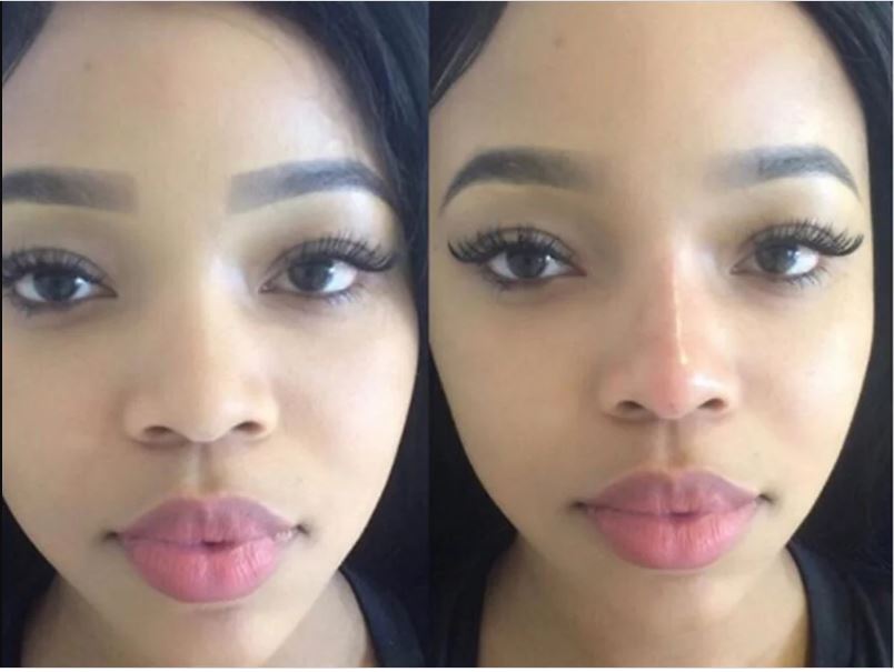 Faith Nketsi before and after plastic surgery