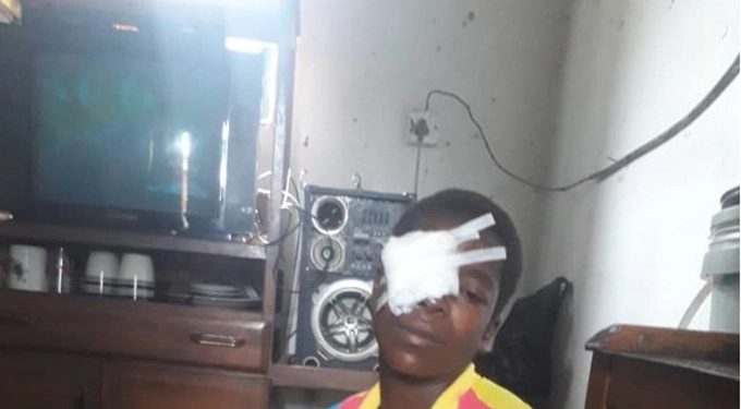 I told my husband to remove his shoes, wife laments after hubby plucks off her eye