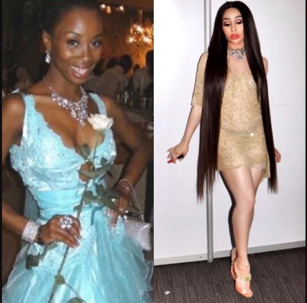 Khanyi Mbau Plastic surgery