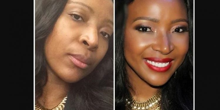 Uyanda Mbuli - Nose Job before and after
