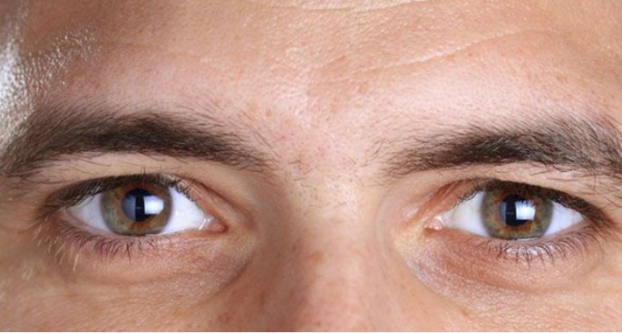 4 Simple ways on how to get clear white eyes naturally