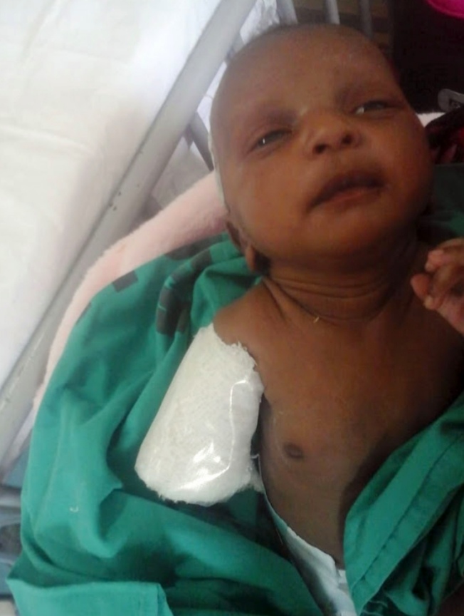 Negligence at Bernice Samuel Hospital costs a four-week old baby an arm