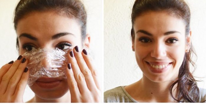 6 Natural ways to get rid of white and blackheads in few days