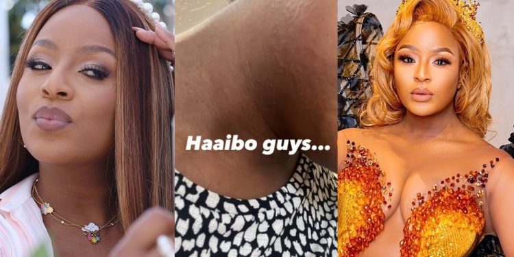 In pictures: Former The Queen actress Jessica Nkosi 'Thando' attacked by a rare skin disease